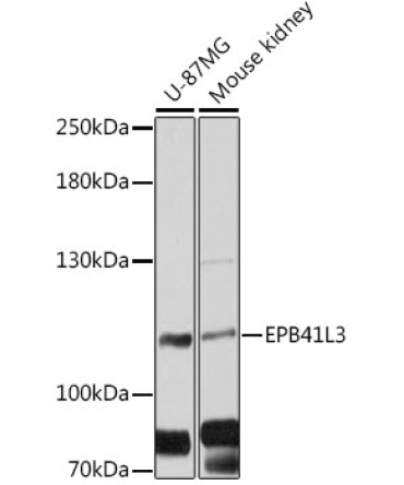 EPB41L3 Rabbit Polyclonal Antibody