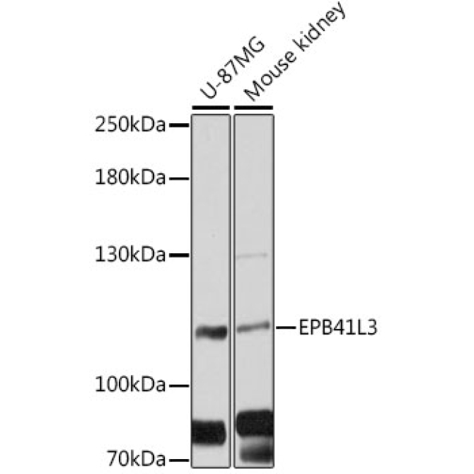 EPB41L3 Rabbit Polyclonal Antibody