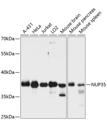 NUP35 Rabbit Polyclonal Antibody