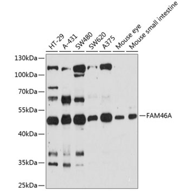 FAM46A Rabbit Polyclonal Antibody