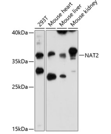 NAT2 Rabbit Polyclonal Antibody
