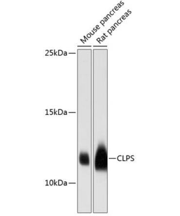 CLPS Rabbit Polyclonal Antibody