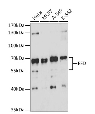 EED Rabbit Polyclonal Antibody