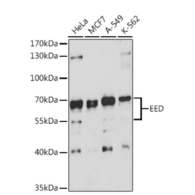 EED Rabbit Polyclonal Antibody