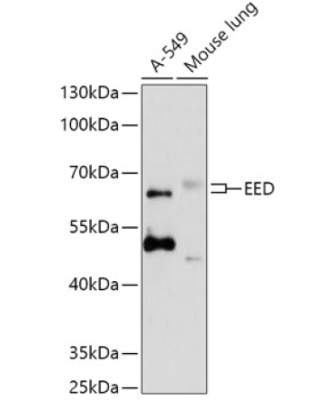 EED Rabbit Polyclonal Antibody