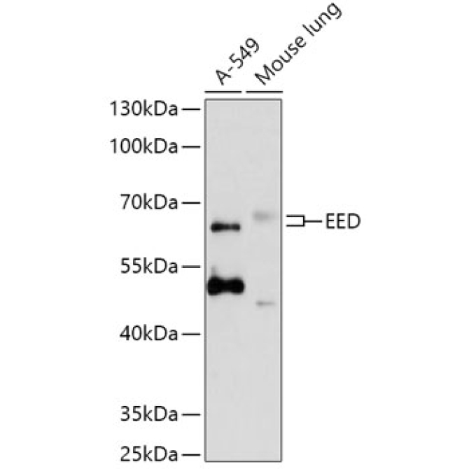 EED Rabbit Polyclonal Antibody