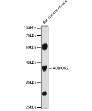 ADIPOR2 Rabbit Polyclonal Antibody