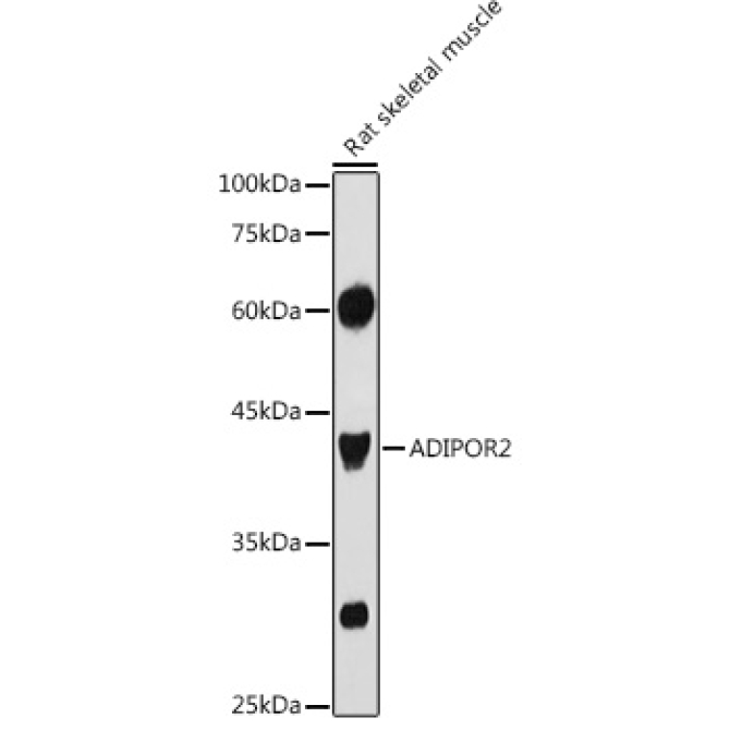 ADIPOR2 Rabbit Polyclonal Antibody