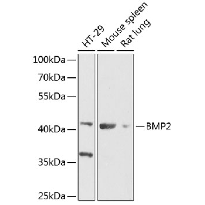 BMP2 Rabbit Polyclonal Antibody