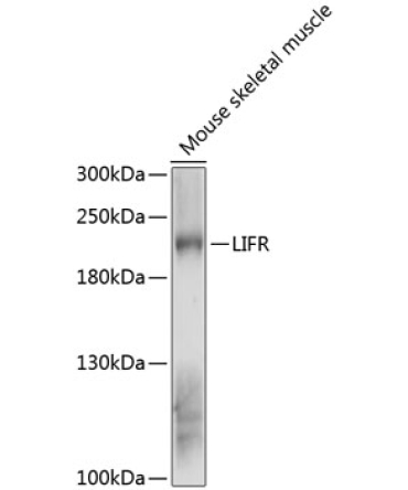 LIFR Rabbit Polyclonal Antibody