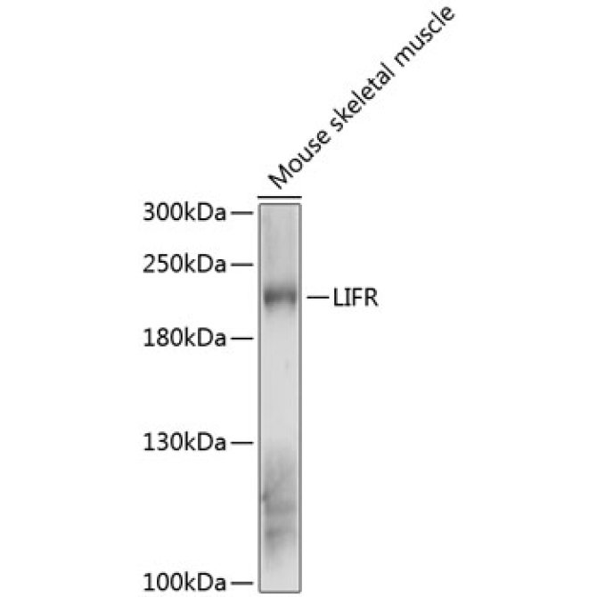 LIFR Rabbit Polyclonal Antibody