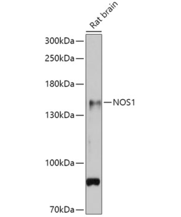 NOS1 Rabbit Polyclonal Antibody