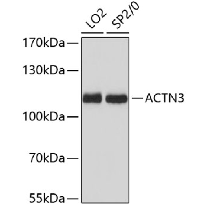 ACTN3 Rabbit Polyclonal Antibody