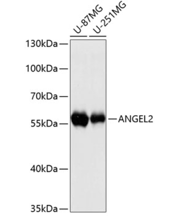 ANGEL2 Rabbit Polyclonal Antibody