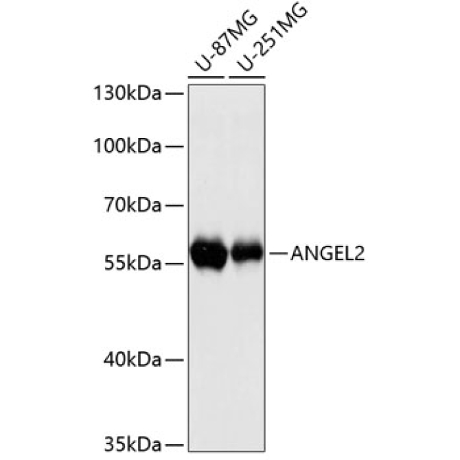 ANGEL2 Rabbit Polyclonal Antibody