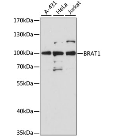 BRAT1 Rabbit Polyclonal Antibody