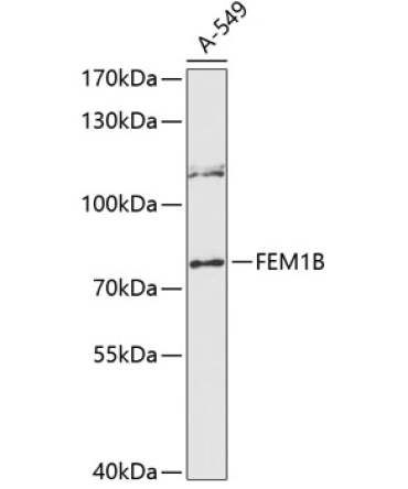 FEM1B Rabbit Polyclonal Antibody