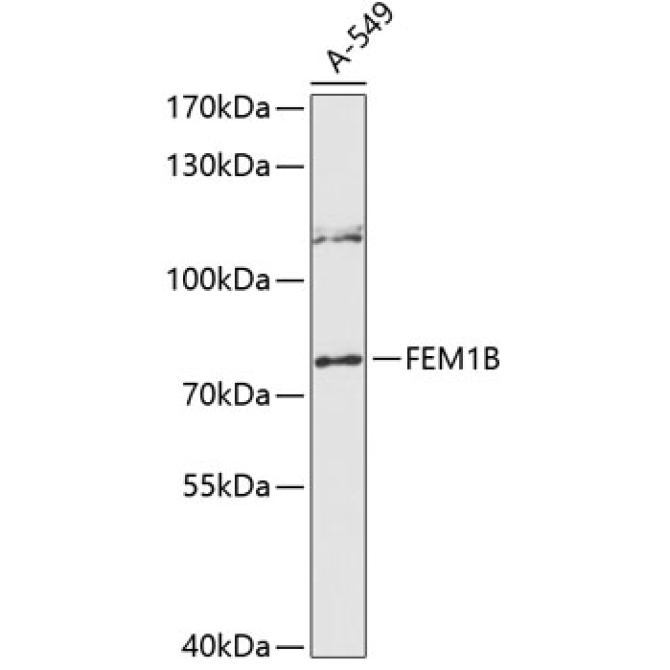 FEM1B Rabbit Polyclonal Antibody
