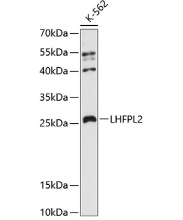 LHFPL2 Rabbit Polyclonal Antibody