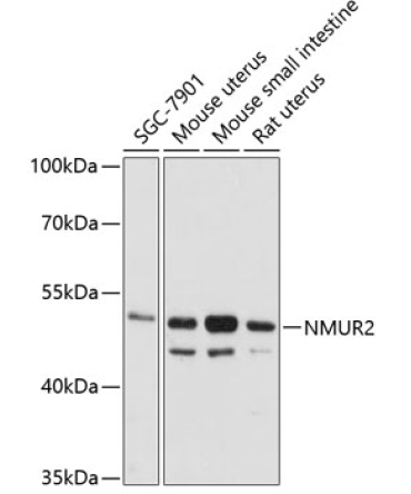 NMUR2 Rabbit Polyclonal Antibody