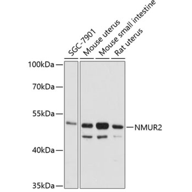 NMUR2 Rabbit Polyclonal Antibody