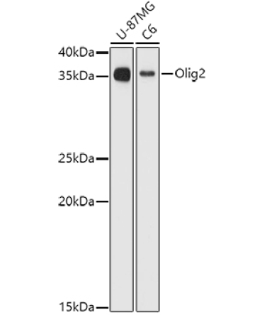 Olig2 Rabbit Polyclonal Antibody