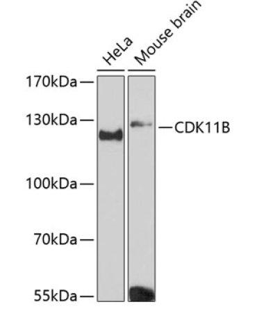 CDK11B Rabbit Polyclonal Antibody