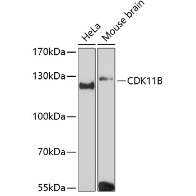 CDK11B Rabbit Polyclonal Antibody