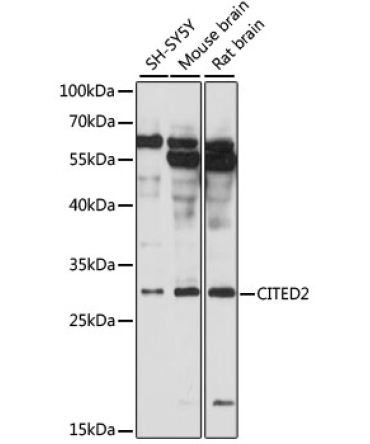 CITED2 Rabbit Polyclonal Antibody