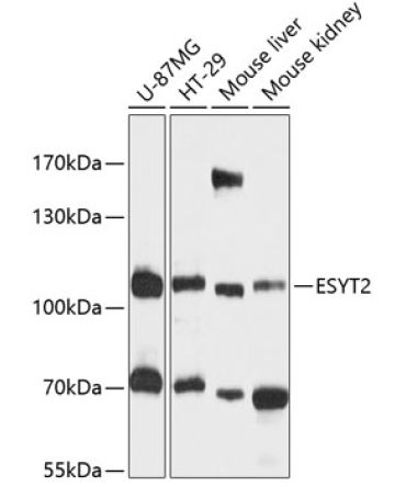 FAM62B Rabbit Polyclonal Antibody