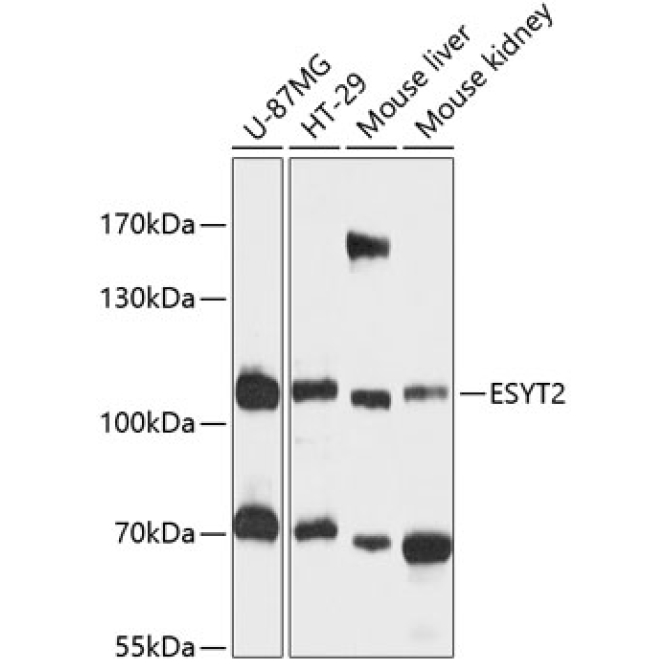 FAM62B Rabbit Polyclonal Antibody