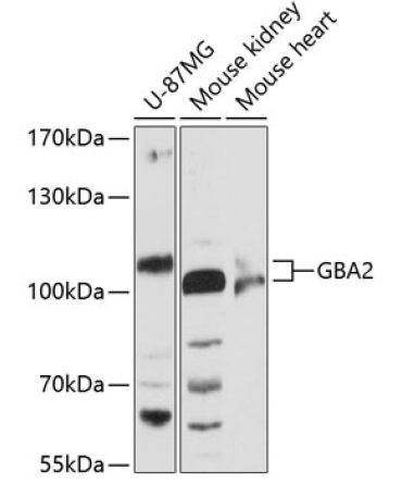 GBA2 Rabbit Polyclonal Antibody