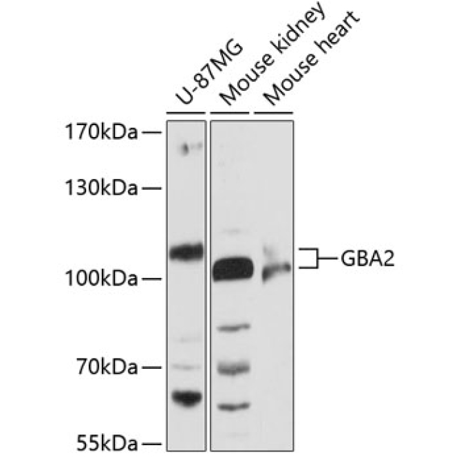 GBA2 Rabbit Polyclonal Antibody