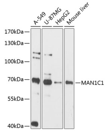 MAN1C1 Rabbit Polyclonal Antibody