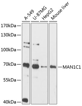 MAN1C1 Rabbit Polyclonal Antibody