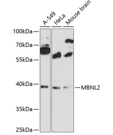 MBNL2 Rabbit Polyclonal Antibody