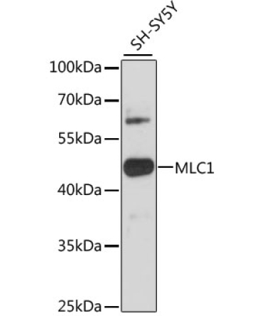 MLC1 Rabbit Polyclonal Antibody