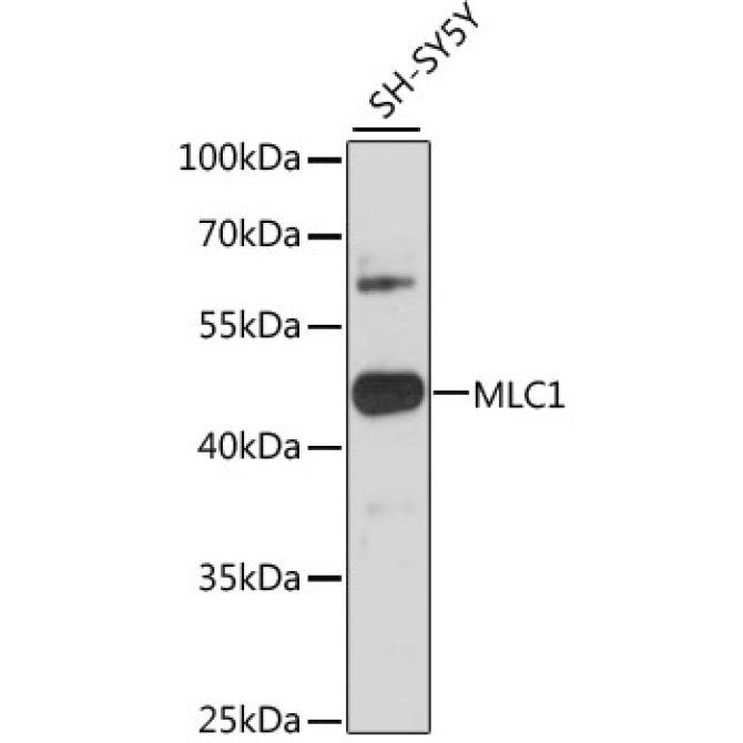 MLC1 Rabbit Polyclonal Antibody