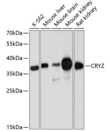 CRYZ Rabbit Polyclonal Antibody