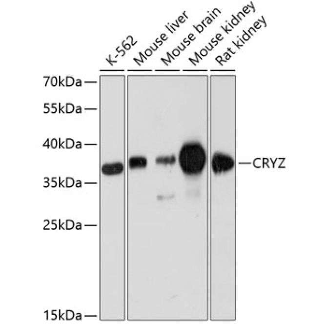 CRYZ Rabbit Polyclonal Antibody