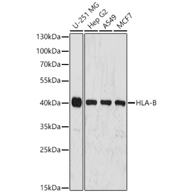 HLA-A+HLA-B+HLA-C Rabbit Polyclonal Antibody