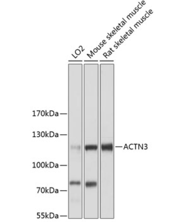 ACTN3 Rabbit Polyclonal Antibody