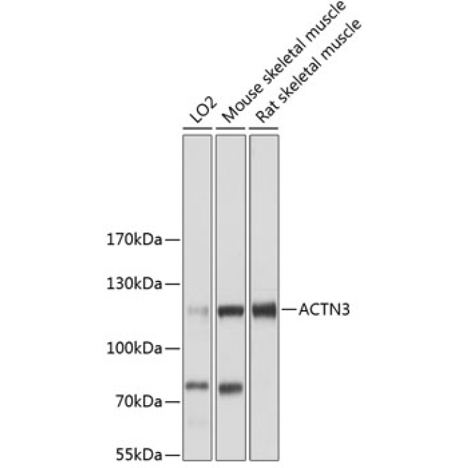 ACTN3 Rabbit Polyclonal Antibody