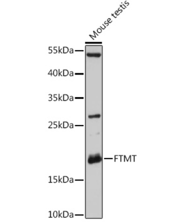FTMT Rabbit Polyclonal Antibody