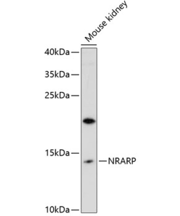 NRARP Rabbit Polyclonal Antibody