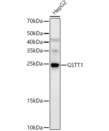 GSTT1 Rabbit Polyclonal Antibody