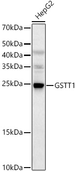 GSTT1 Rabbit Polyclonal Antibody