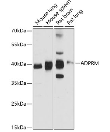 ADPRM Rabbit Polyclonal Antibody