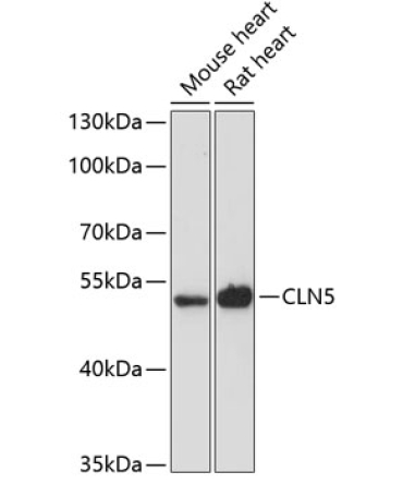 CLN5 Rabbit Polyclonal Antibody