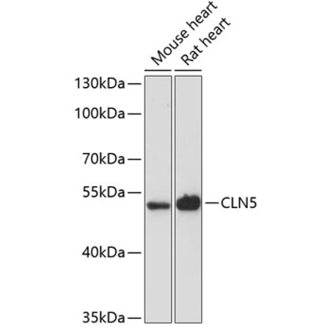 CLN5 Rabbit Polyclonal Antibody